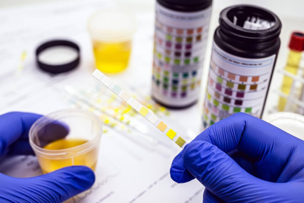 Exames de Urina e Parasitológico de Fezes